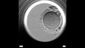Video of embryo development using the Vitrolife EmbryoScope