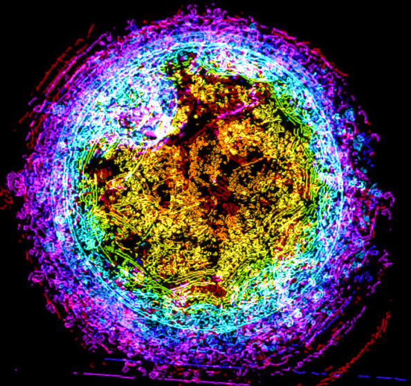 IVF Software for the IVF lab