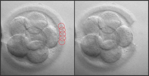 LYKOS®/LYKOS® DTS Laser [Quote]