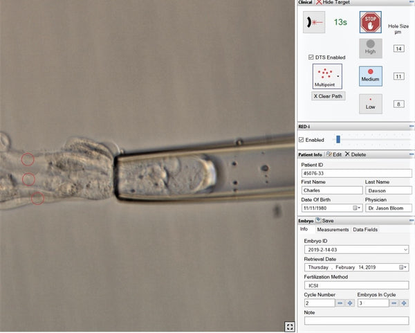 LYKOS®/LYKOS® DTS Laser [Quote]