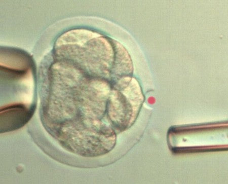 LYKOS®/LYKOS® DTS Laser [Quote]