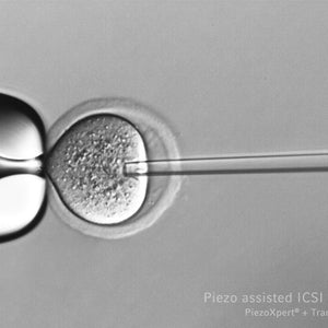 Calibre Scientific; PiezoXpert®, incl. actuator, foot control and spacer plate
