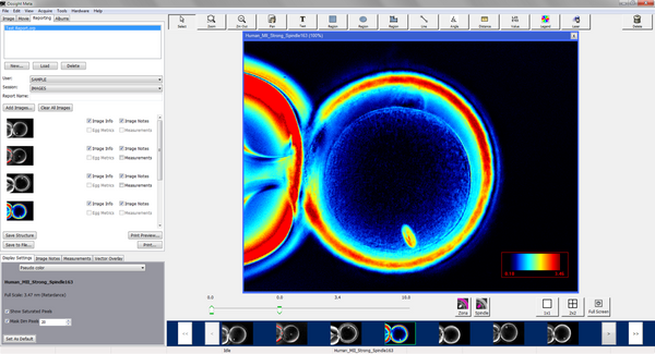 Oosight Imaging System® [Quote]