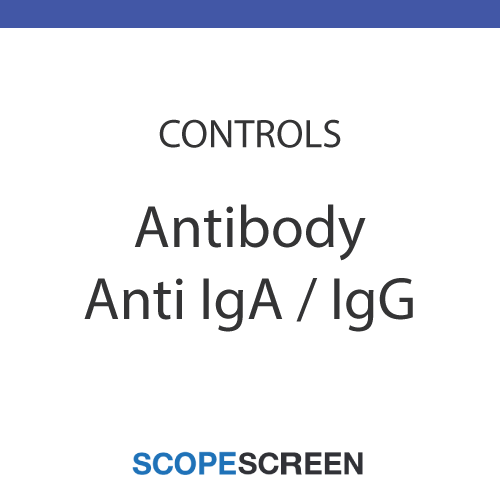 Sperm Antibody IgG and IgA Controls